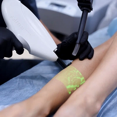 Виброплатформа при варикозе