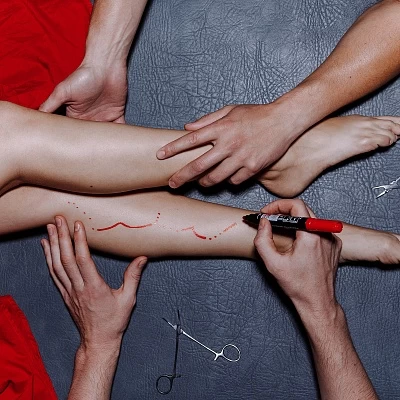 Болезни вен и их симптомы