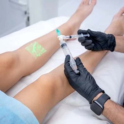 Сосудистые звездочки — причины и лечение