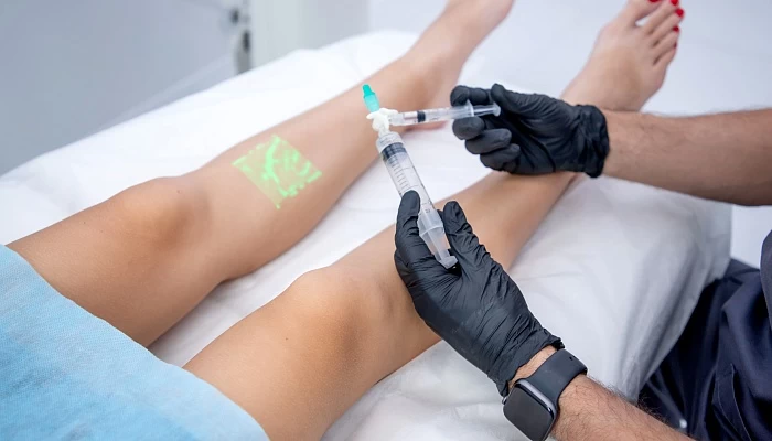 Сосудистые звездочки — причины и лечение