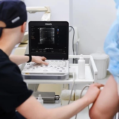 УЗИ вен ног