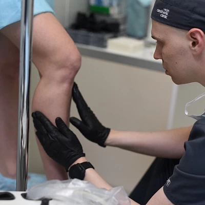 Можно ли при варикозе делать массаж ног