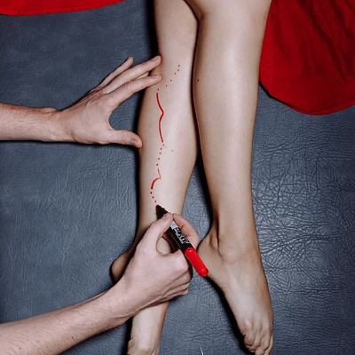 Чешутся вены на ногах