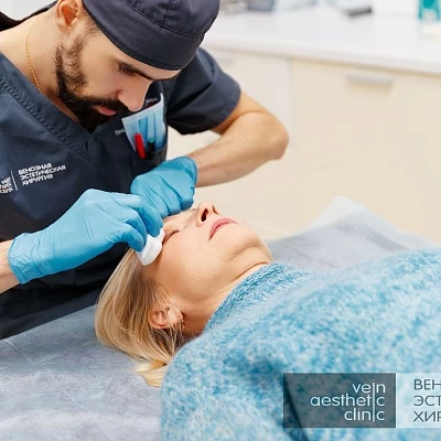 Сосудистая сетка на лице — как избавиться от купероза?