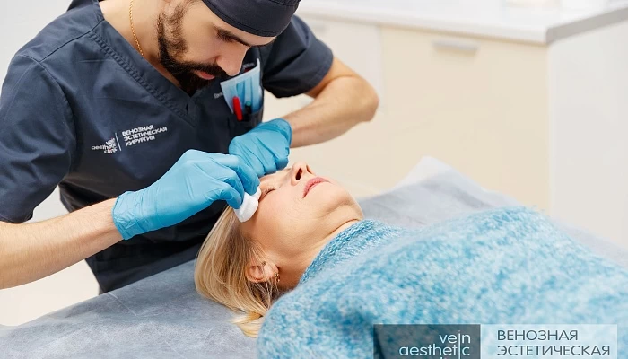 Сосудистая сетка на лице — как избавиться от купероза?