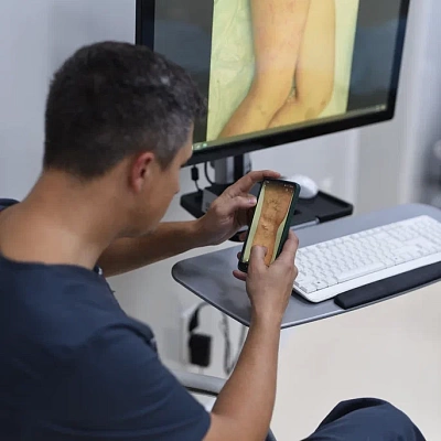 Прессотерапия при варикозе