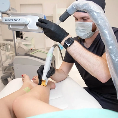 Сосудистые звездочки: не просто косметический дефект