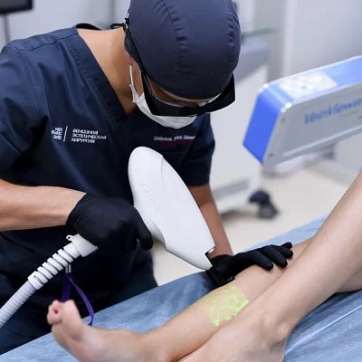 Склерозирование вен на ноге